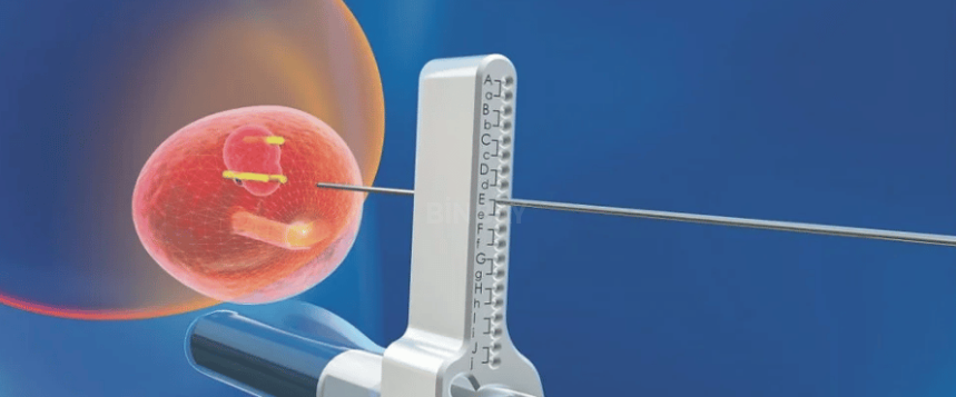 Prostate Fusion Biopsy