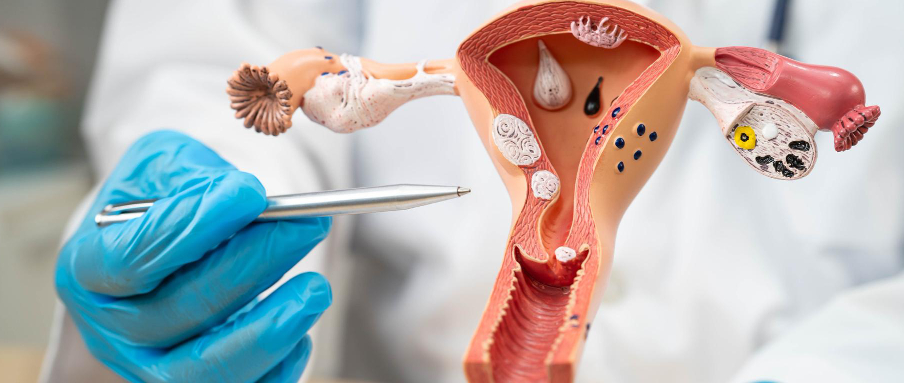 TOT (Transobturator Tape)