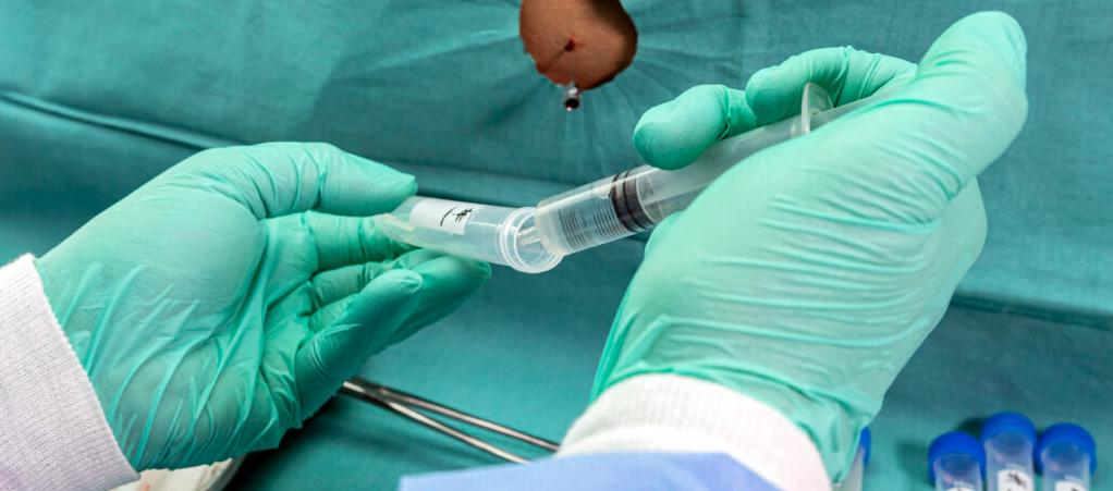 Пълнител за главичката на пениса