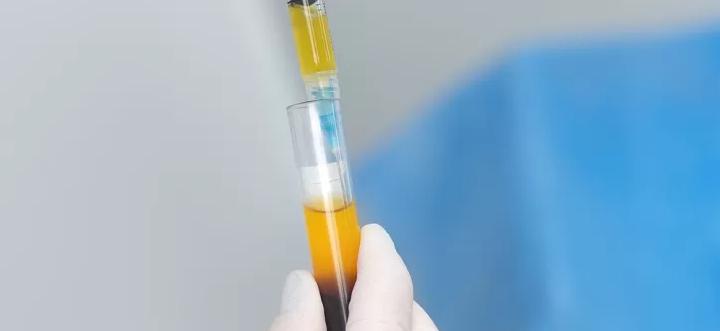 Терапия с Плазма Богата на Тромбоцити (PRP)