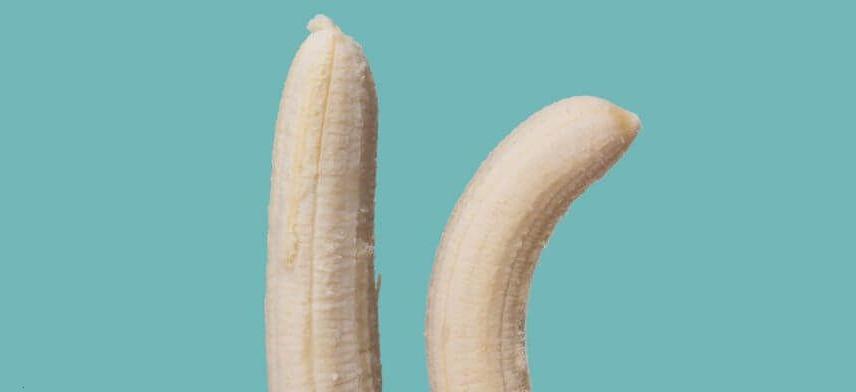 Congenital Penile Curvature