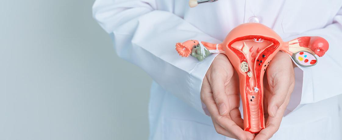 Sistosel (Mesane Sarkması)