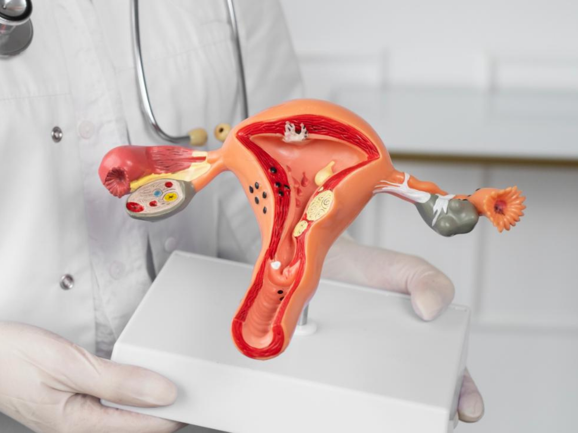 What is HoLEP? HoLEP (Holmium Laser Enucleation of the Prostate) is an advanced, minimally invasi...